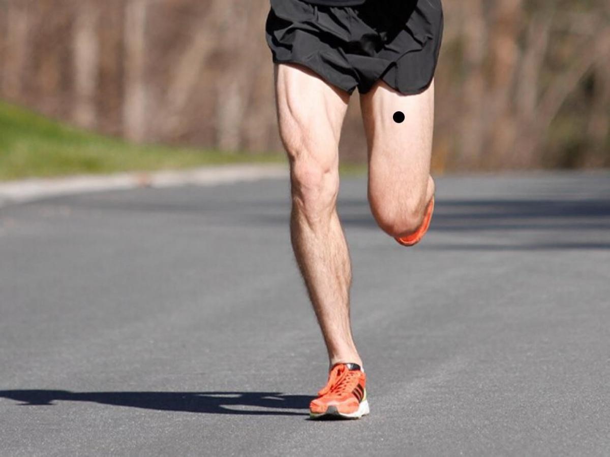 Nốt ruồi ở đùi trước