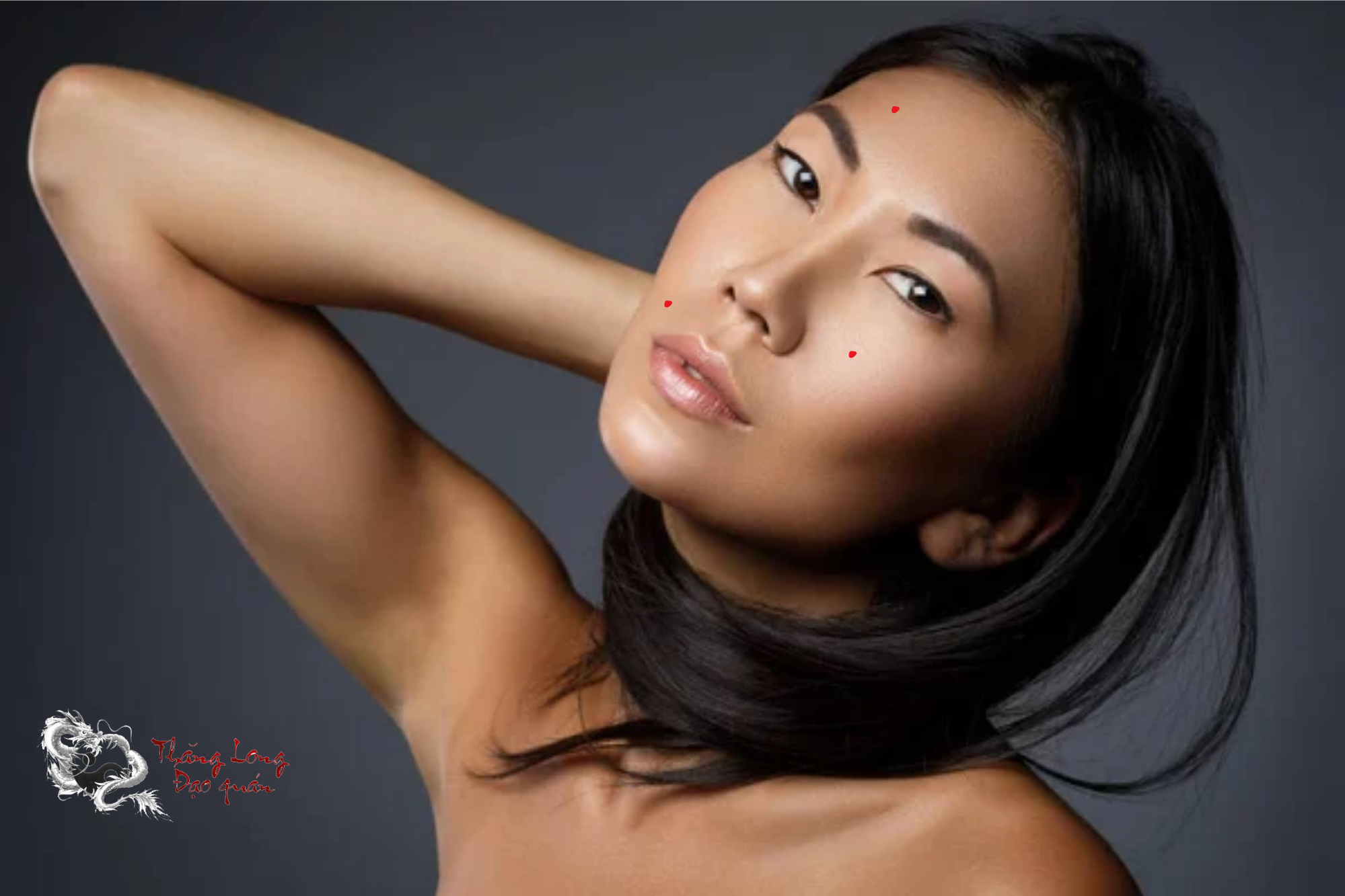 nốt ruồi son là gì