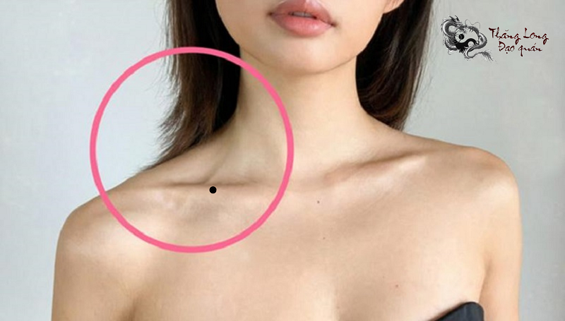 nốt ruồi ở xương quai xanh