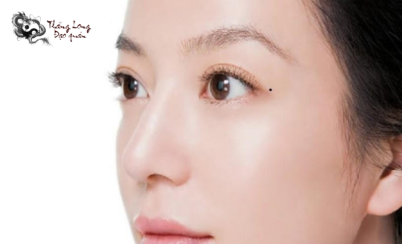 nốt ruồi ở đuôi mắt phải