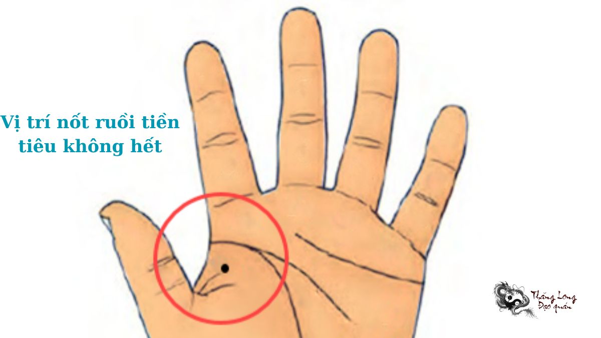 Vị trí nốt ruồi tiền tiêu không hết