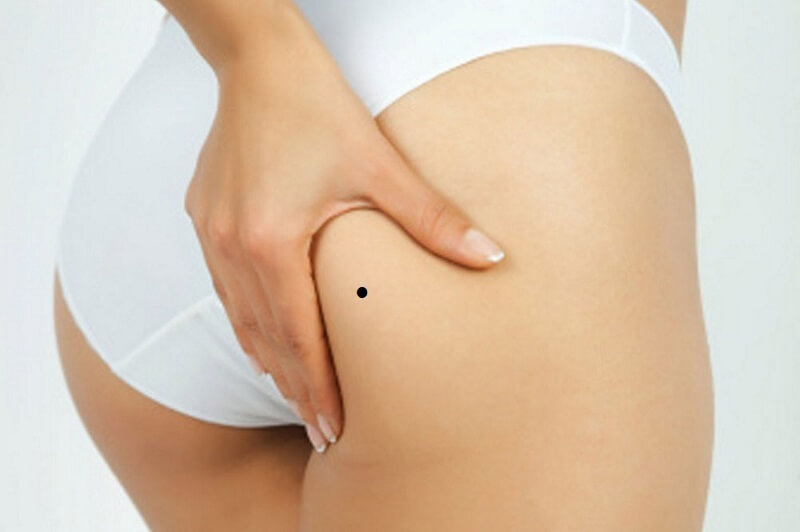 Ý nghĩa nốt ruồi ở mông phải phụ nữ