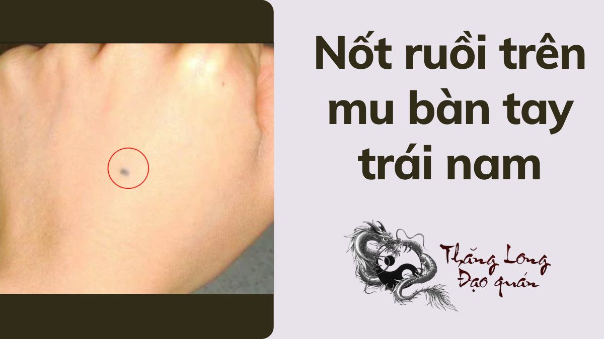 ý nghĩa nốt rồi trên mu bàn tay trái nam